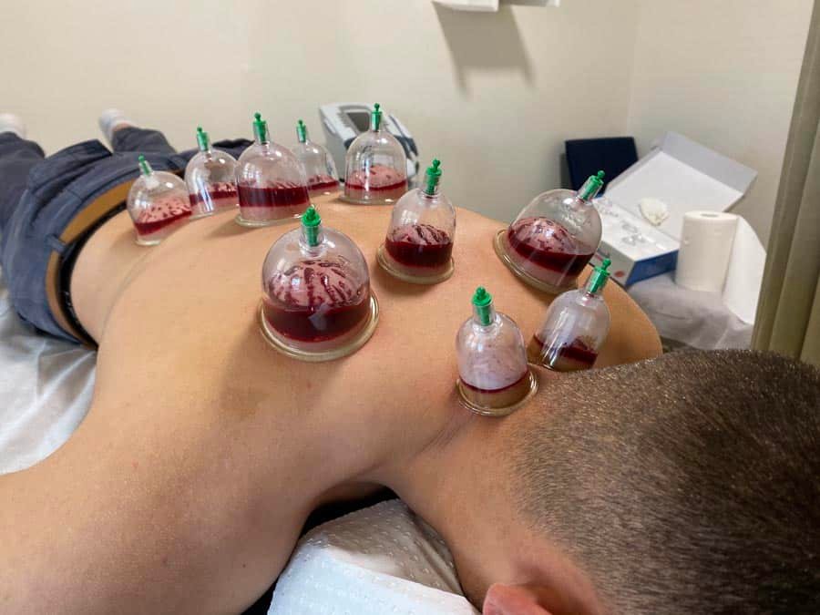 Hijama Conditions